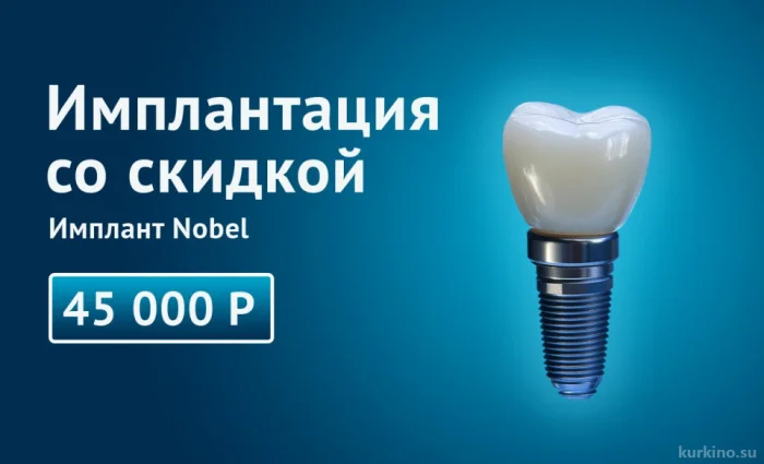 Имплантация со скидкой. Импланты Nobel 45 000руб.